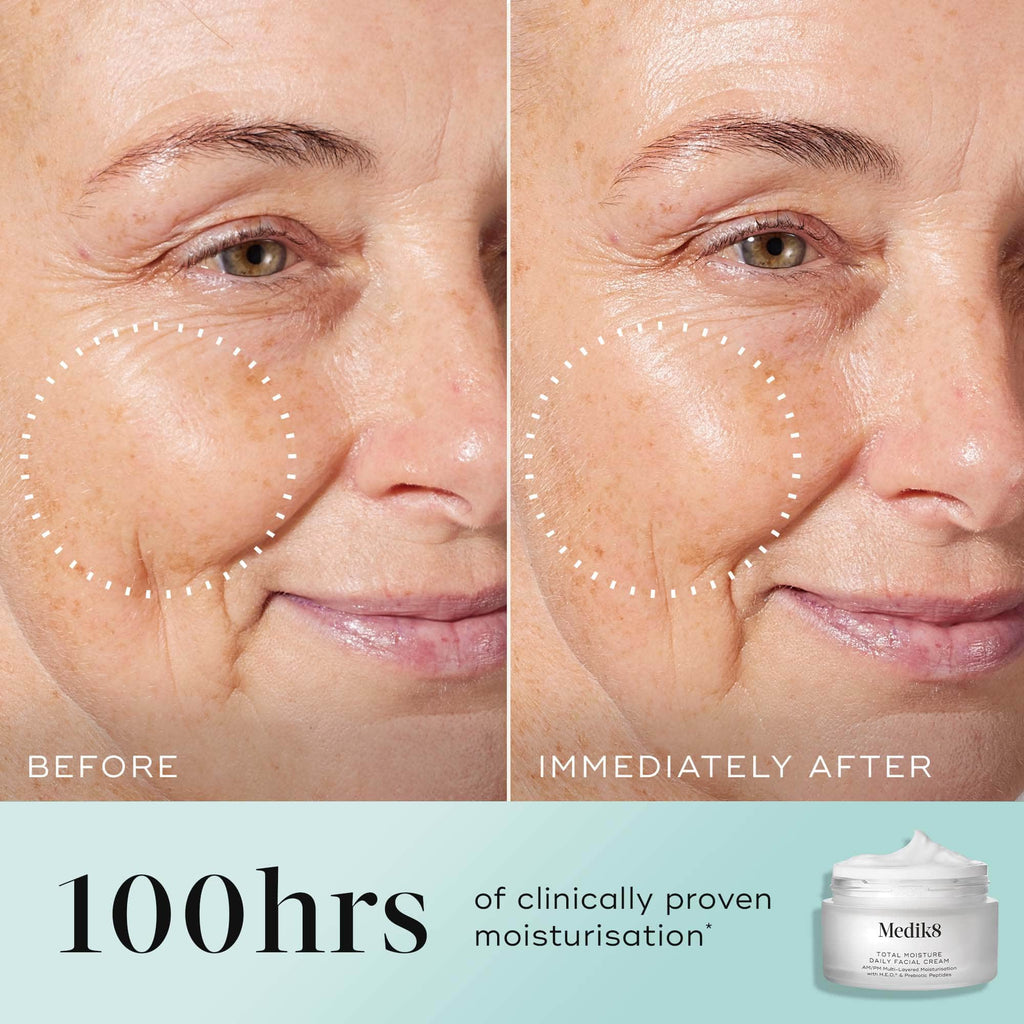 Split image showing a woman's cheek before (left) and after (right) applying Medik8 Total Moisture Daily Facial Cream™, highlighting reduced fine lines. Text: "100hrs of clinically proven moisturisation." Contains Medik8 product image.