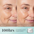 Split image showing a woman's cheek before (left) and after (right) applying Medik8 Total Moisture Daily Facial Cream™, highlighting reduced fine lines. Text: "100hrs of clinically proven moisturisation." Contains Medik8 product image.